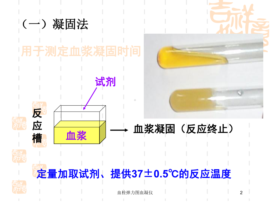 血栓弹力图血凝仪培训课件.ppt_第2页