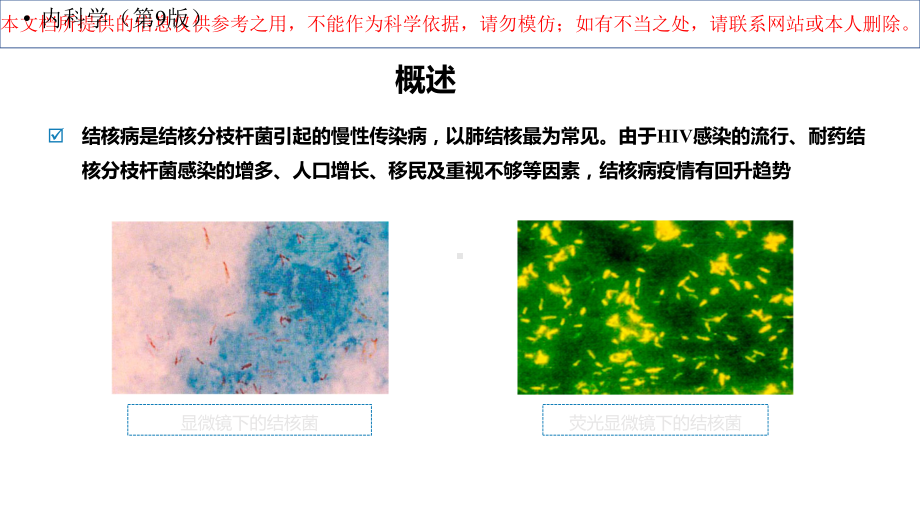 肺结核内科学呼吸培训课件.ppt_第3页