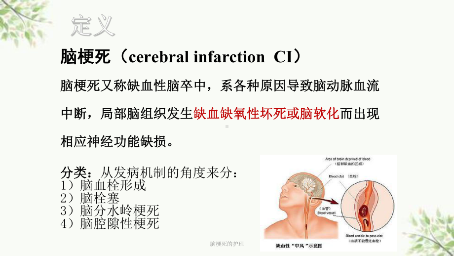 脑梗死的护理课件.ppt_第2页