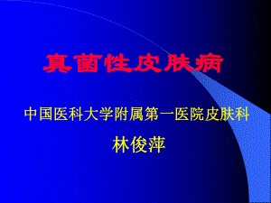 真菌性皮肤病课件1.ppt