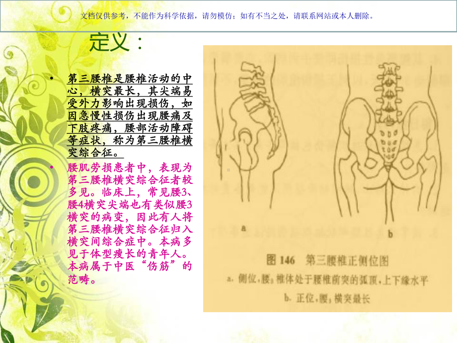 腰三横突综合症课件.ppt_第1页