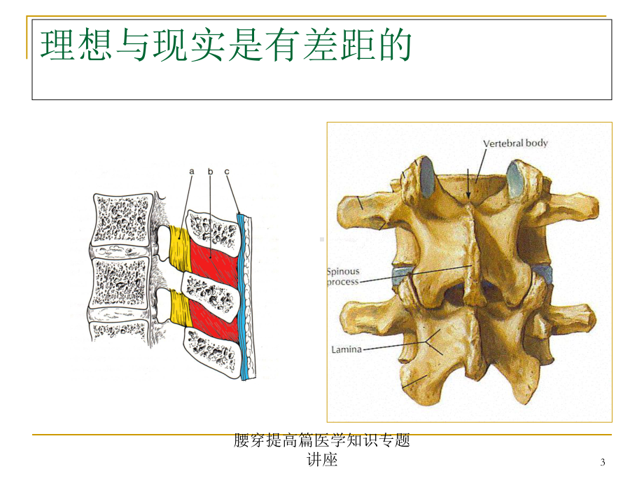 腰穿提高篇医学知识专题讲座培训课件.ppt_第3页