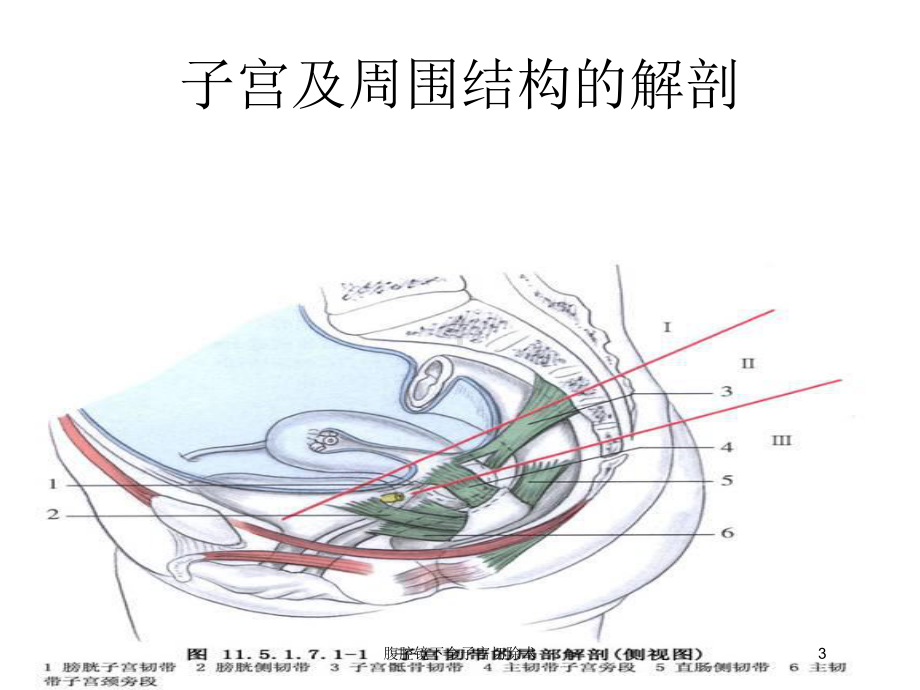 腹腔镜下全子宫切除术培训课件.ppt_第3页