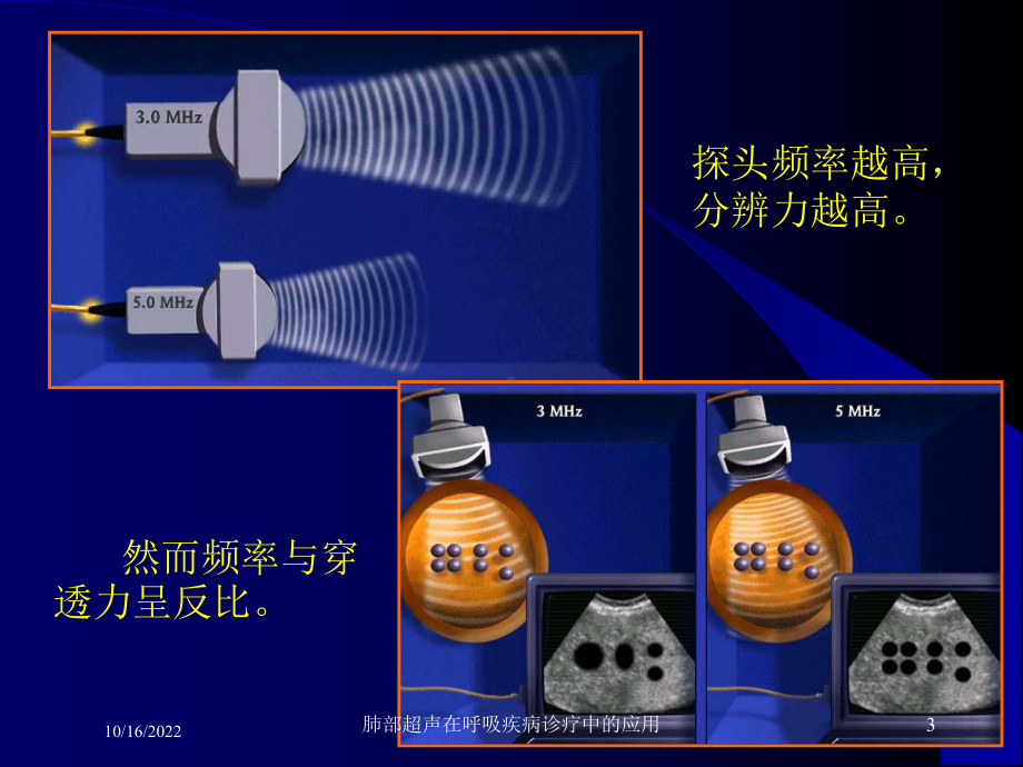 肺部超声在呼吸疾病诊疗中的应用培训课件.ppt_第3页