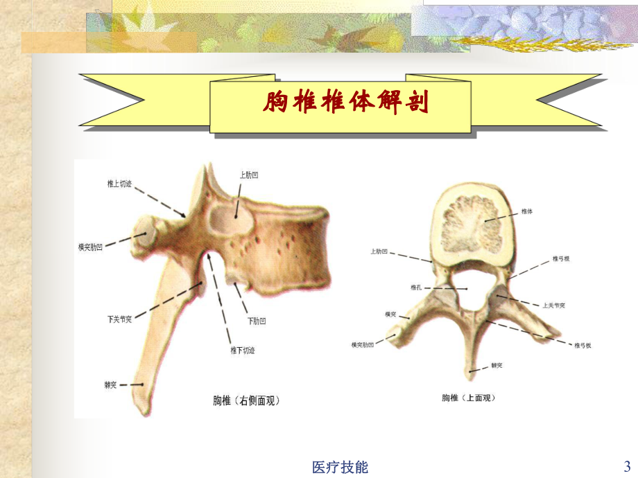 胸椎骨折(医学技术)课件.ppt_第3页