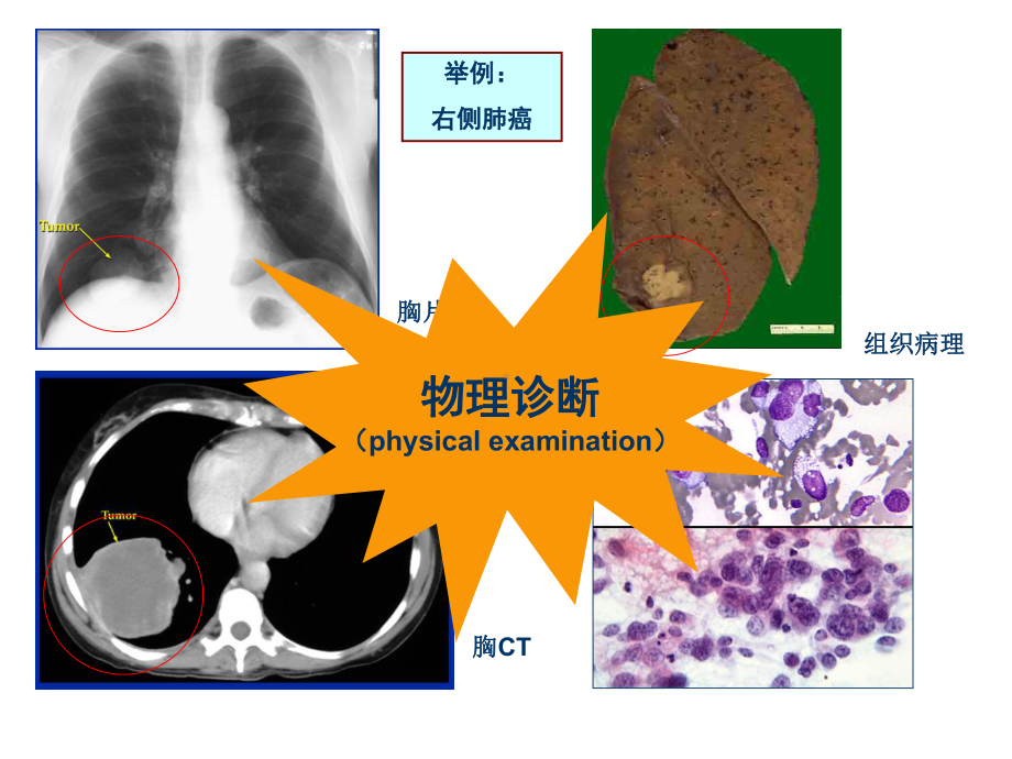 胸部体检课件.ppt_第3页