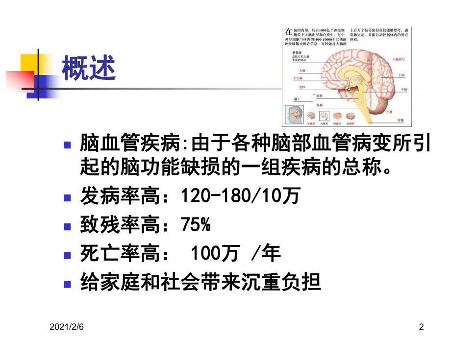 脑血管疾病诊治课件.ppt_第2页