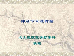 神经节来源肿瘤课件.ppt