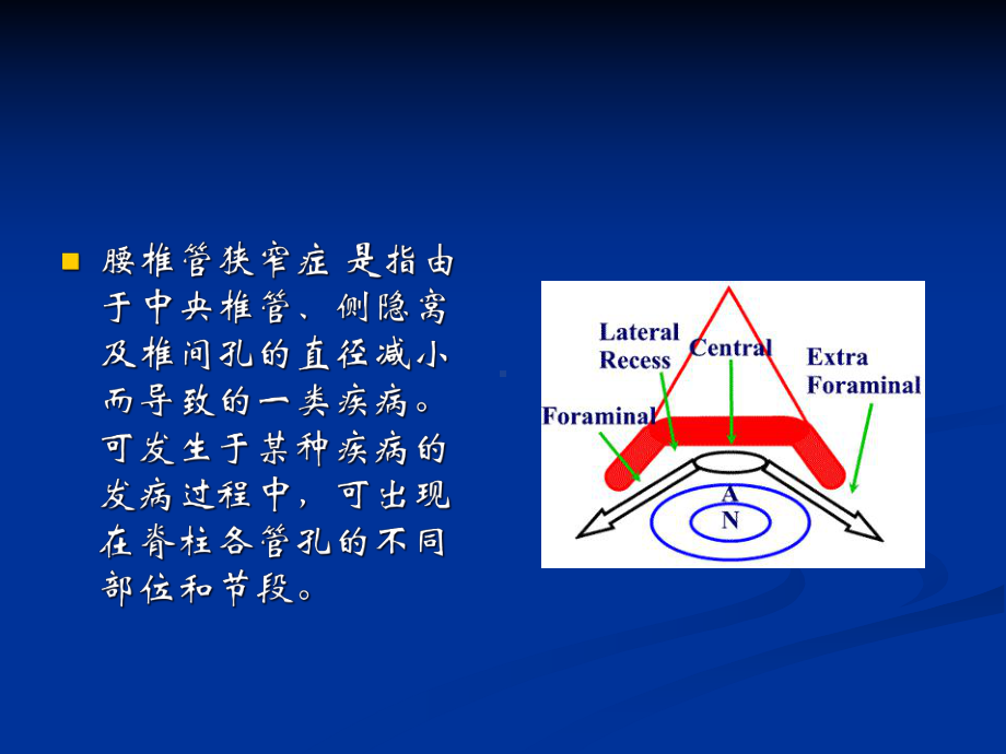 退行性腰椎管狭窄分解课件.ppt_第2页