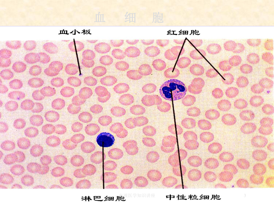 血液医学知识讲座培训课件.ppt_第3页