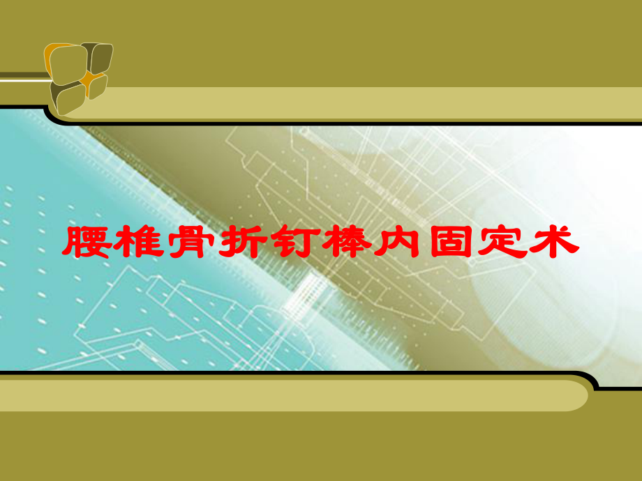 腰椎骨折钉棒内固定术培训课件.ppt_第1页