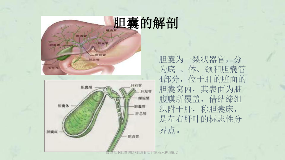 腹腔镜下胆囊切除+胆总管切开取石术护理配合课件.ppt_第2页