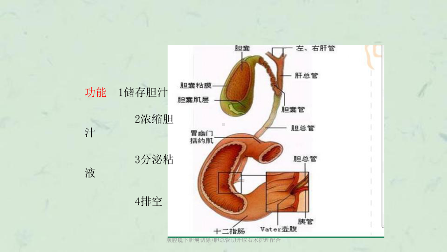 腹腔镜下胆囊切除+胆总管切开取石术护理配合课件.ppt_第3页