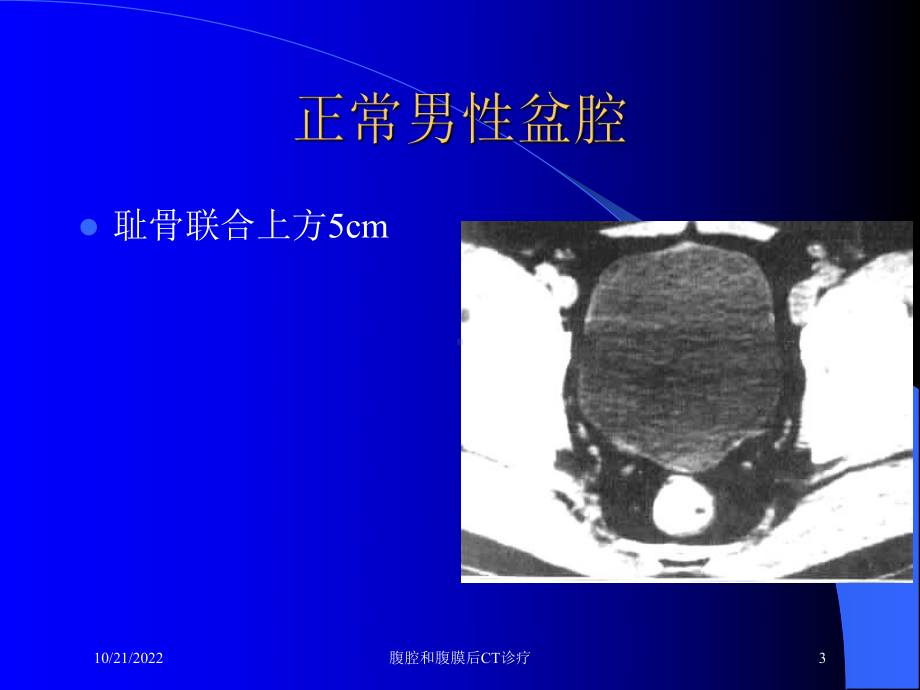 腹腔和腹膜后CT诊疗培训课件.ppt_第3页