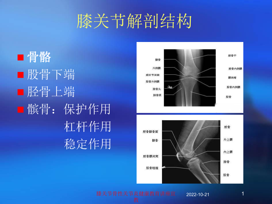 膝关节骨性关节炎健康教育讲座宣教培训课件.ppt_第1页