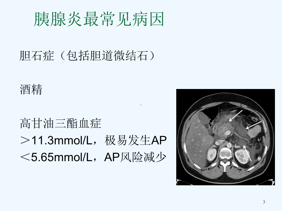 血浆置换治疗高脂血症性重症急性胰腺炎课件.ppt_第3页