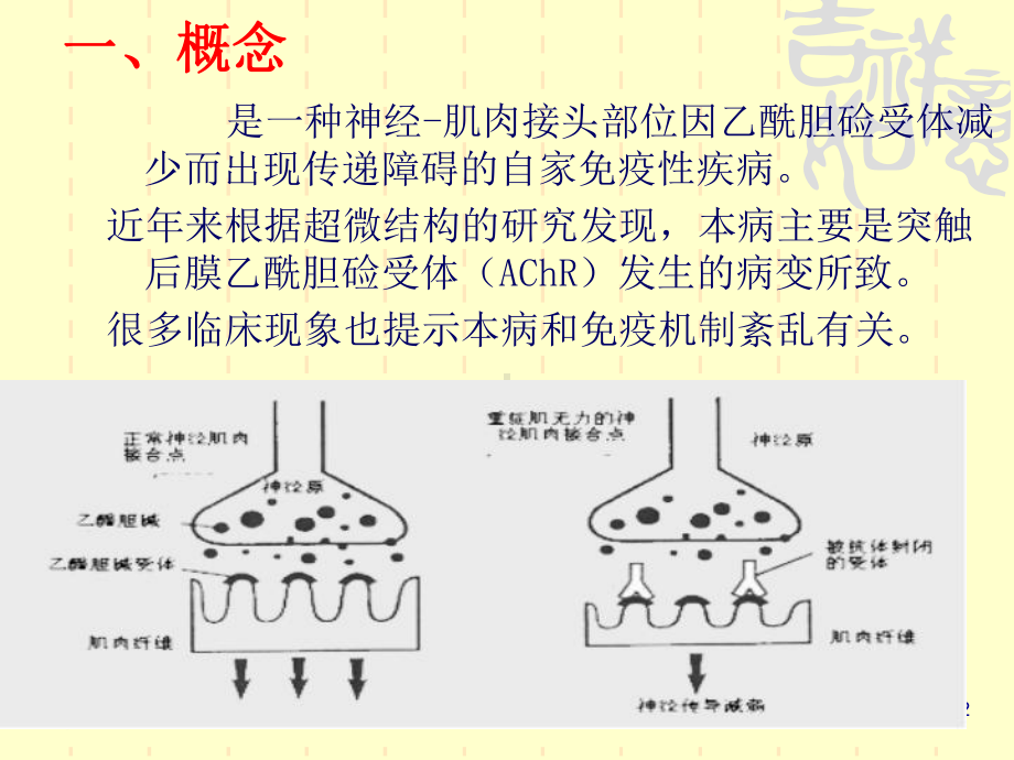 重症肌无力的护理培训课件.ppt_第2页