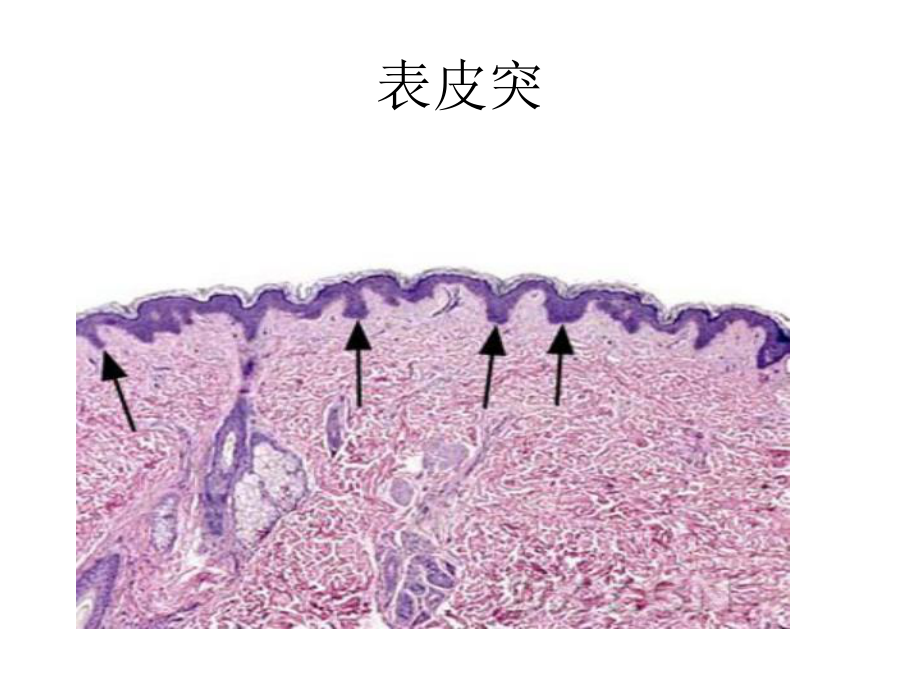 皮肤病理知从入门到高级课件.ppt_第2页