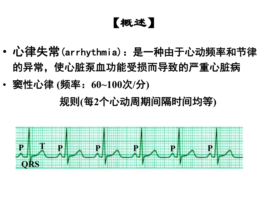 药理学抗心律失常药课件.pptx_第2页