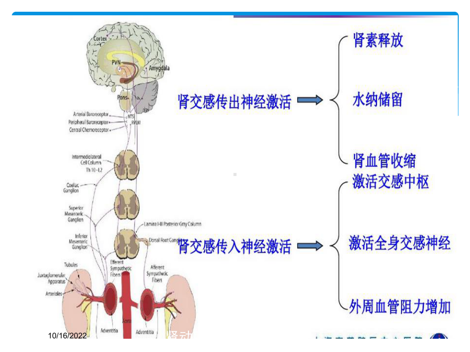 肾动脉交感消融术治疗原发性高血压培训课件.ppt_第3页