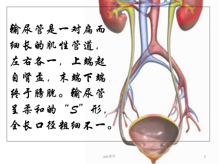 输尿管梗阻病人-课件.ppt_第2页