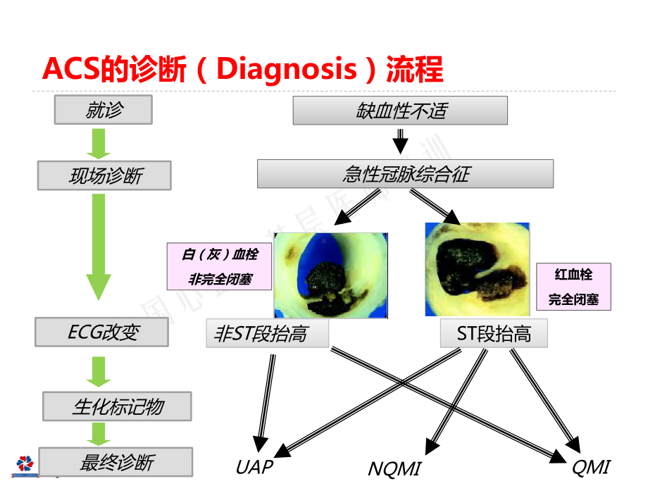 急性心肌梗死的处理措施概要课件.ppt_第3页