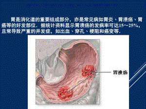 胃肠道间质瘤影像表现课件.ppt