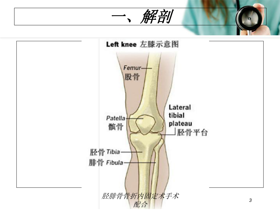 胫腓骨骨折内固定术手术配合培训课件.ppt_第3页