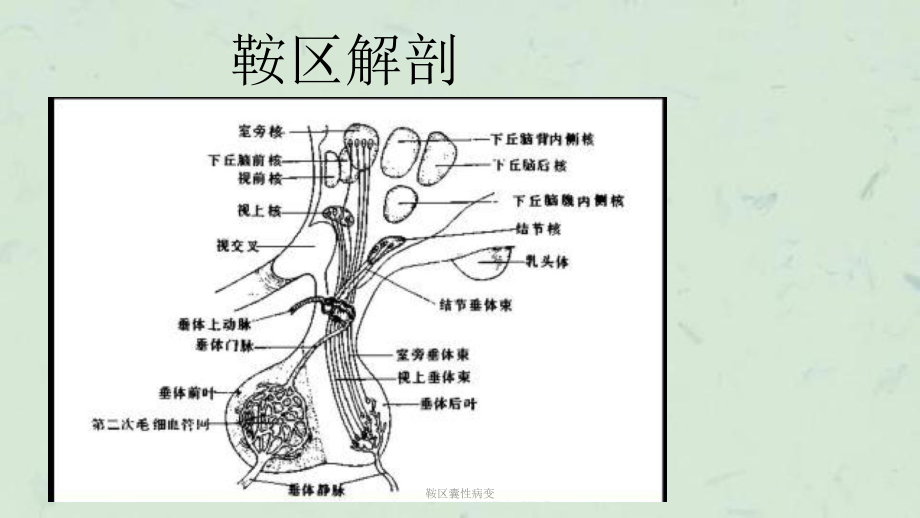 鞍区囊性病变课件.pptx_第2页