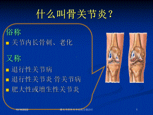 膝关节骨性关节炎的分级治疗培训课件.ppt