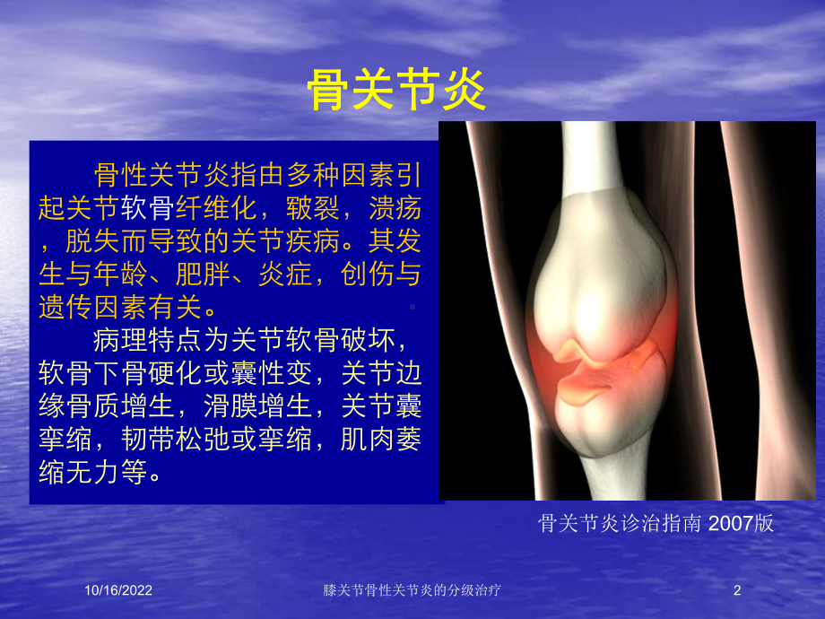 膝关节骨性关节炎的分级治疗培训课件.ppt_第2页