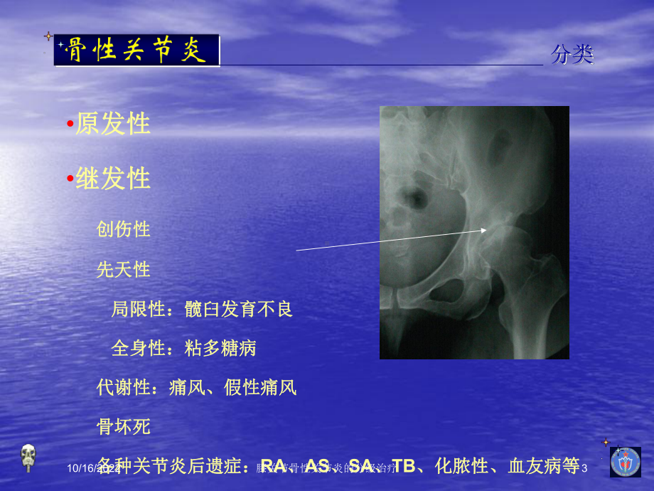 膝关节骨性关节炎的分级治疗培训课件.ppt_第3页