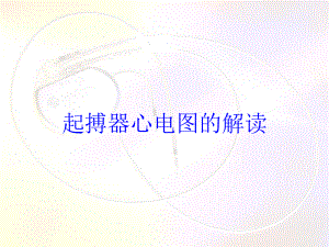 起搏器心电图的解读培训课件.ppt