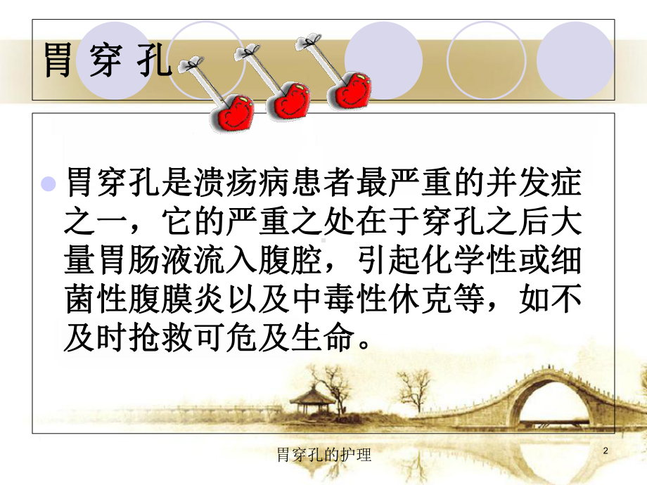 胃穿孔的护理培训课件.ppt_第2页