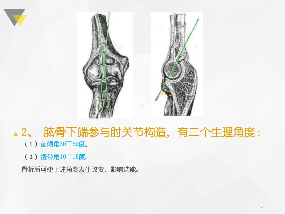 中医学肱骨髁上骨折课件.ppt_第3页