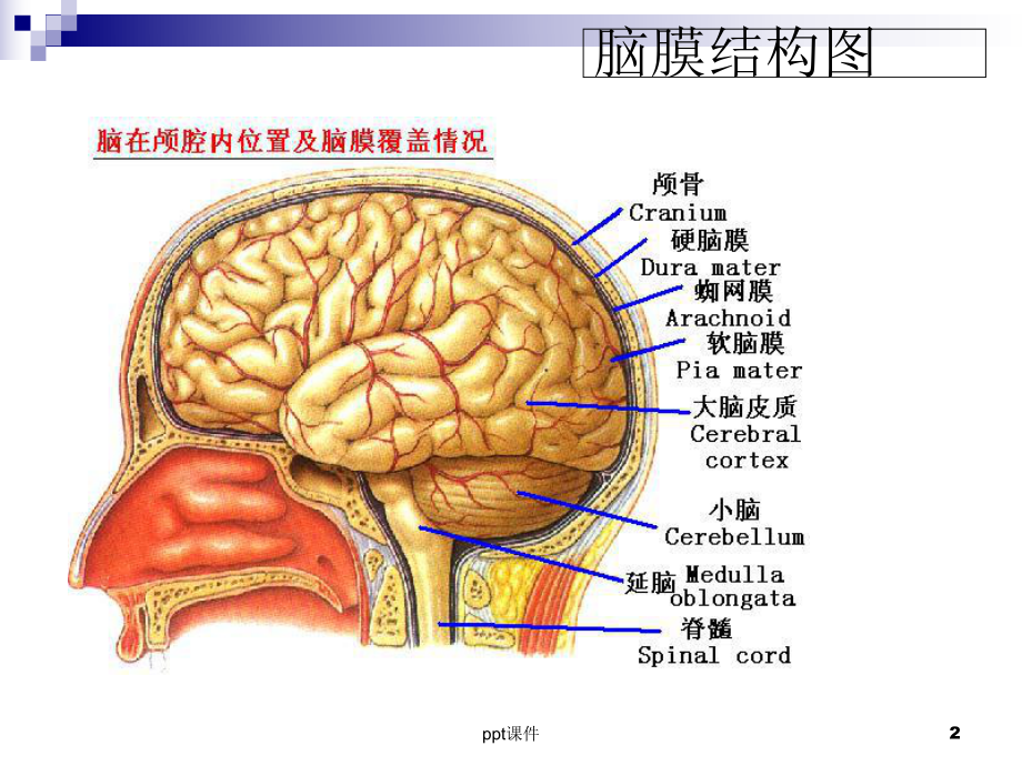 脑膜瘤的护理查房-课件.ppt_第2页