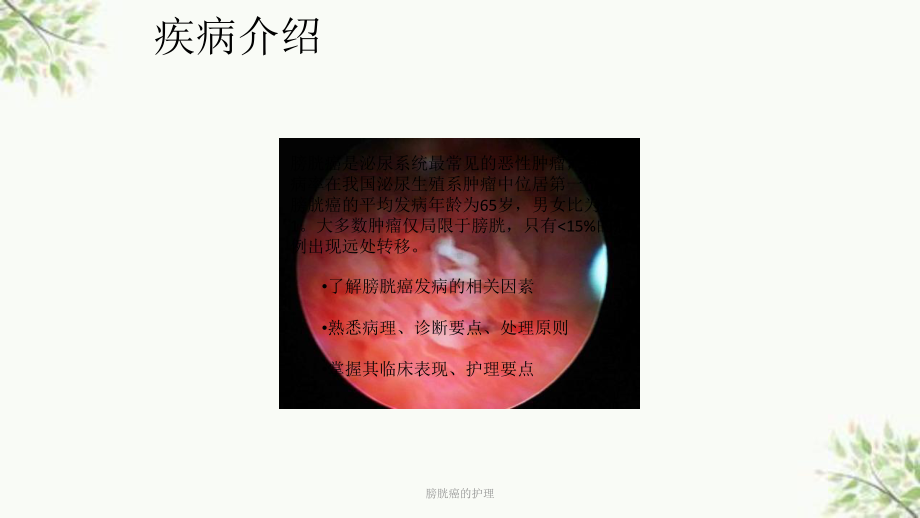 膀胱癌的护理课件.ppt_第2页