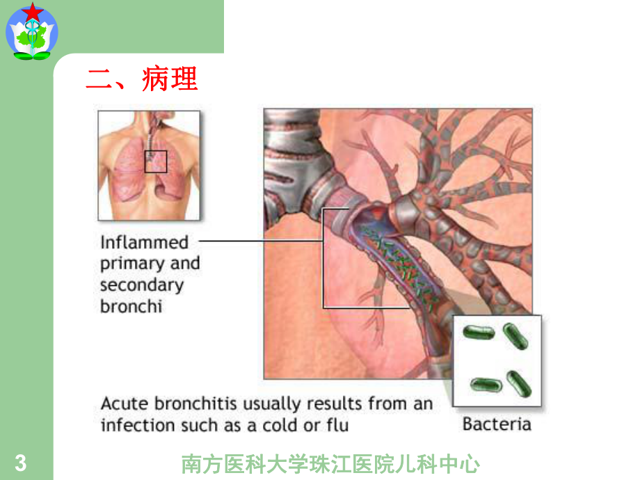 急性支气管炎分解课件.ppt_第3页