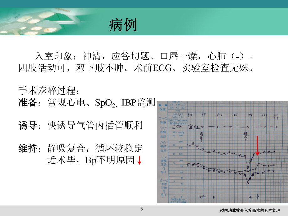 颅内动脉瘤介入栓塞术的麻醉管理培训课件.ppt_第3页