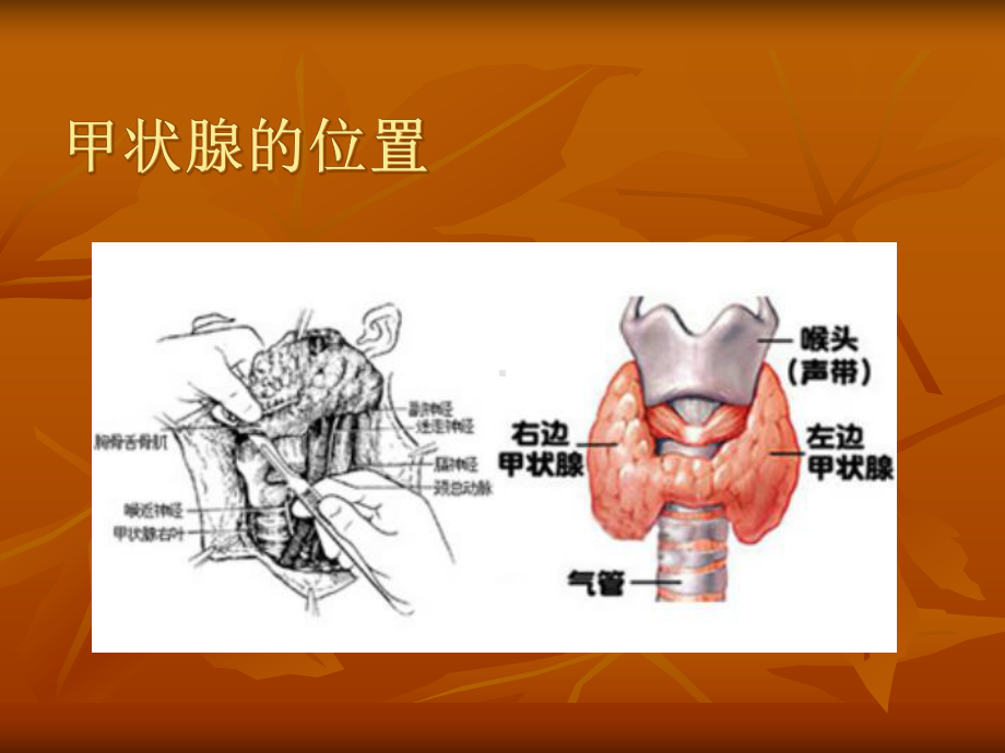 甲减的病例讨论医学课件.ppt_第3页