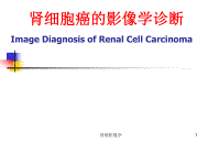 肾癌影像学课件.ppt