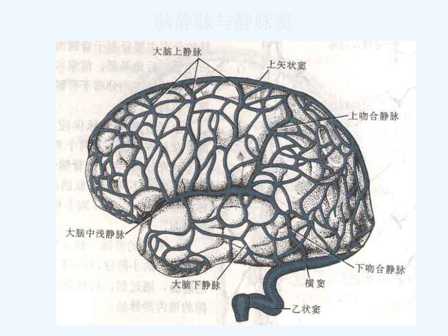 静脉窦血栓知识课件2.ppt_第3页