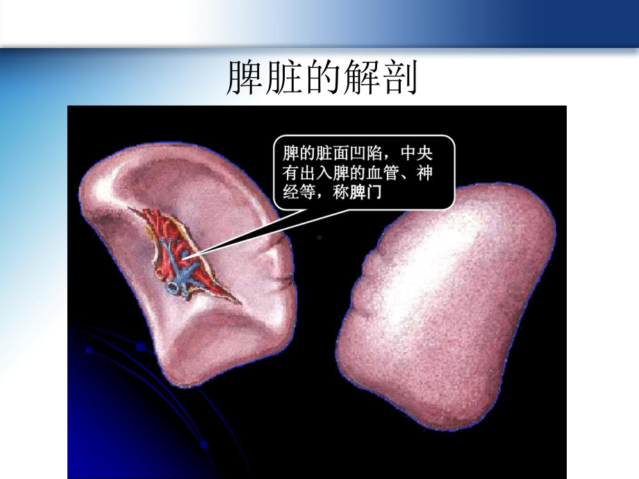 脾破裂的超声诊断课件.ppt_第2页