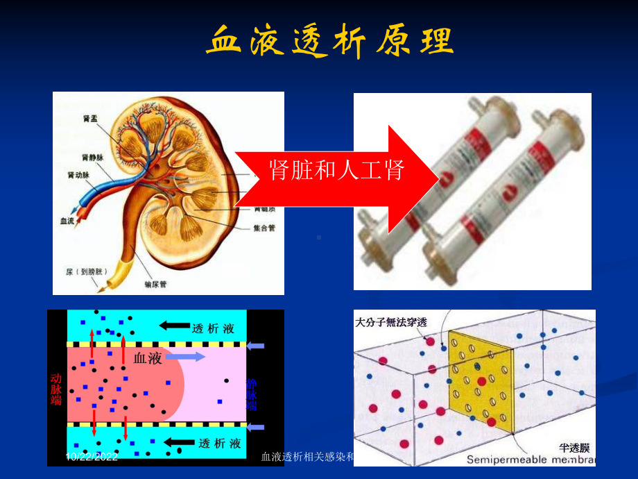 血液透析相关感染和防控培训课件.ppt_第2页