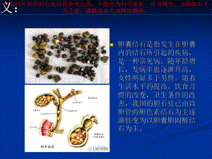 胆结石课件专业知识讲座培训课件.ppt