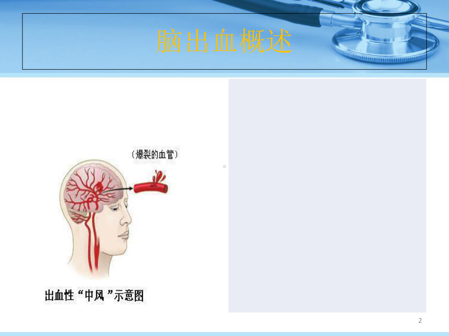 脑出血护理查房课件-2.ppt_第2页