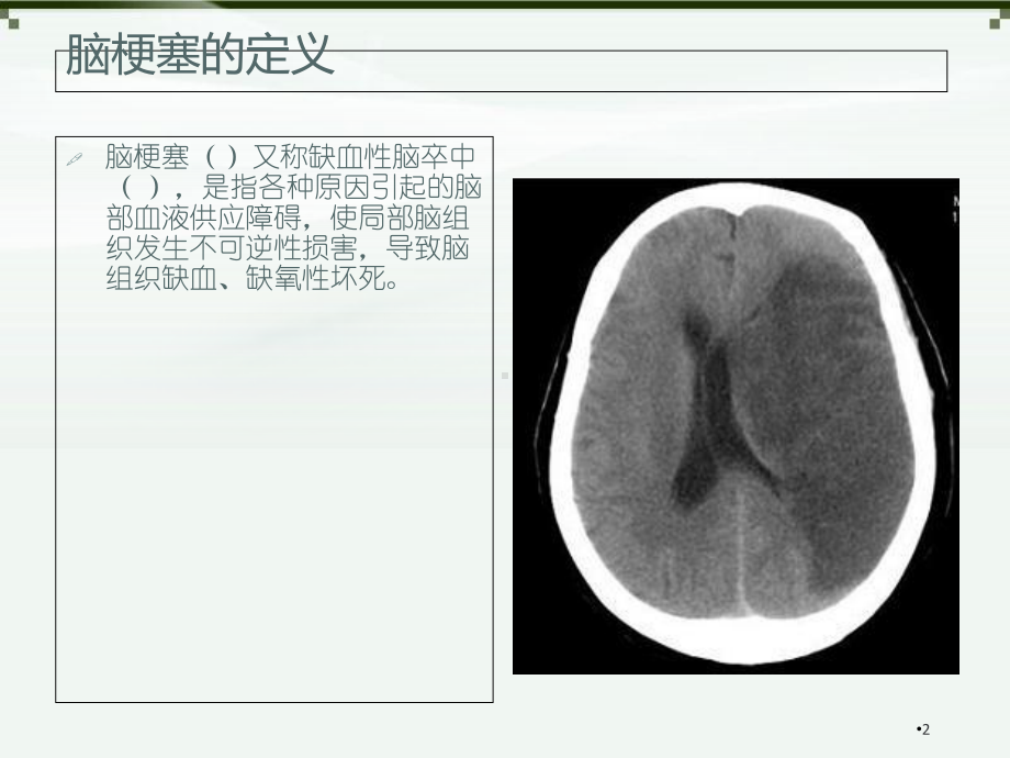 脑梗塞分类与治疗学习课件.ppt_第2页