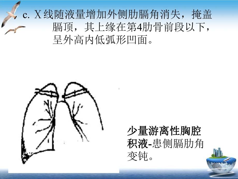 胸腔积液的影像诊断实用版课件.ppt_第3页