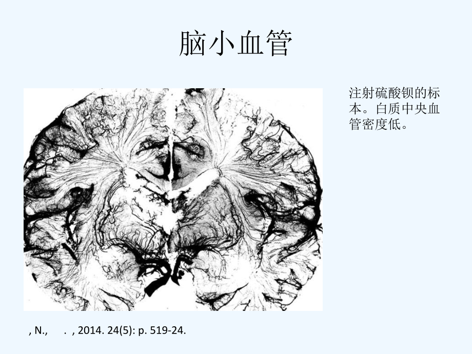 脑小血管病概念与治疗课件.ppt_第1页