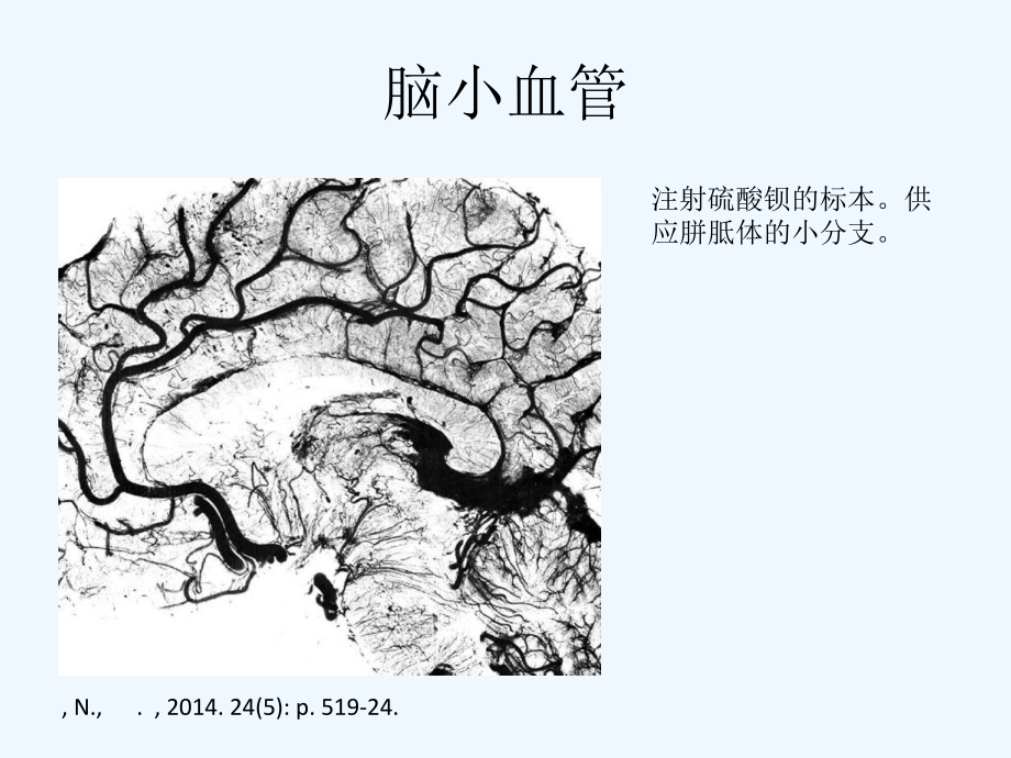 脑小血管病概念与治疗课件.ppt_第2页